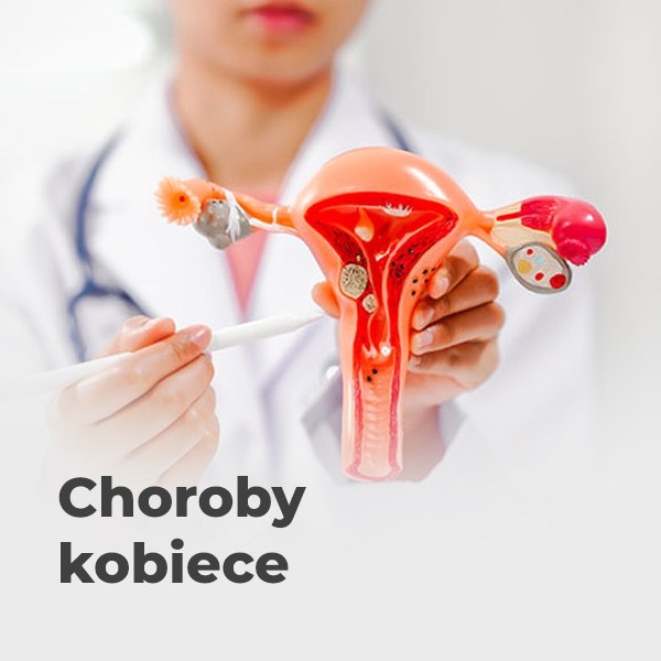 Choroby kobiece leczenie